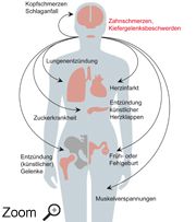 Auswirkung auf den ganzen Körper